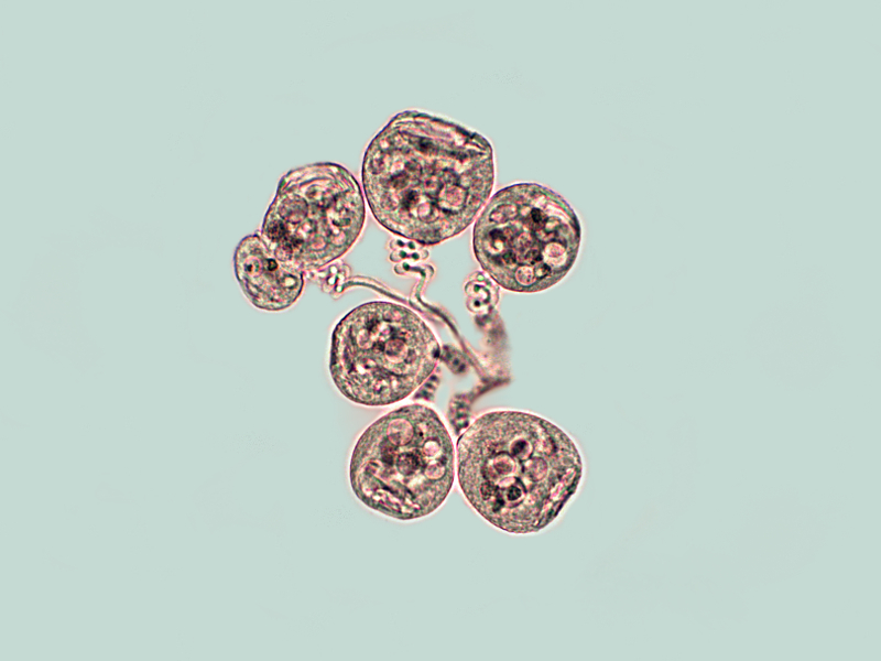 Vorticella